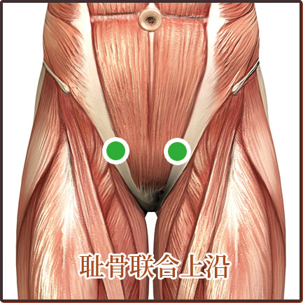 盆腔炎、尿道炎、宮頸炎、陰道炎等婦科疾病貼敷位置示意圖
